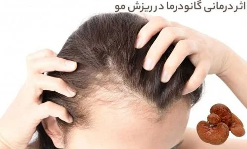 قهوه گانودرما برای ریزش مو