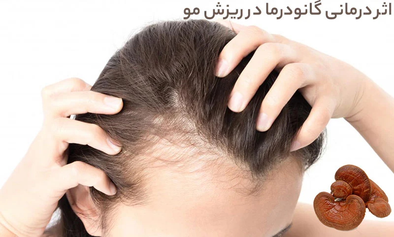 گانودرما | قهوه قهوه گانودرما برای ریزش مو