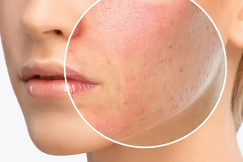  آیا حساسیت پوستی می تواند باعث مشکلات سلامتی شود؟