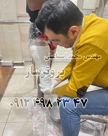 آشنایی با مراحل انتخاب و تهیه پروتز پا