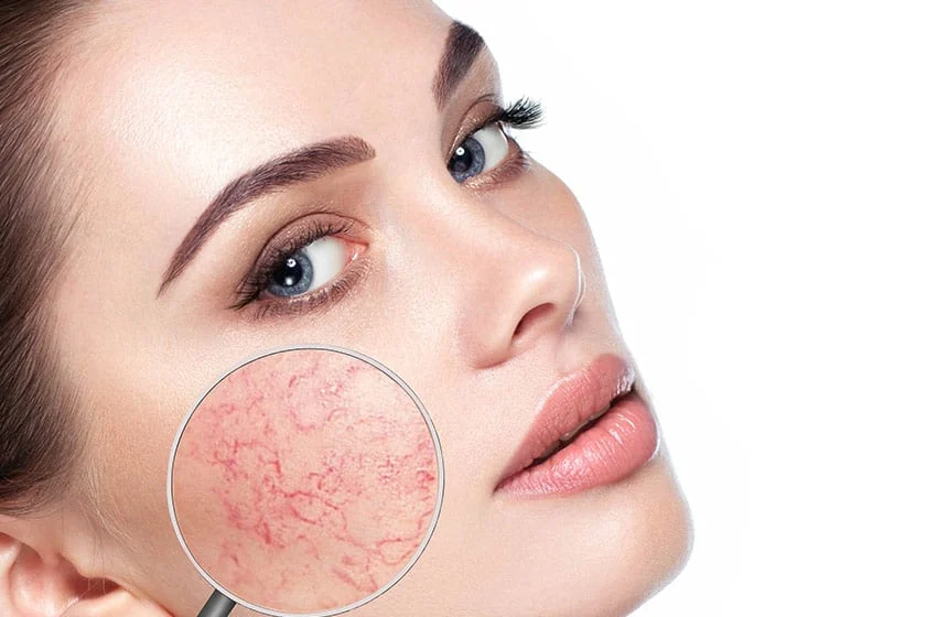 سلامتی | پوست آیا حساسیت پوستی می تواند باعث مشکلات سلامتی شود؟